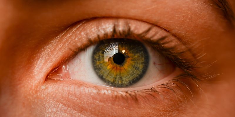 Lentilles de contact